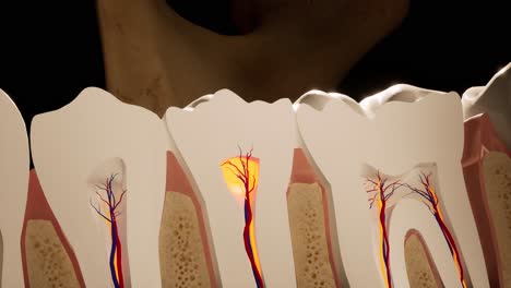 toothache. anatomical detailed section of the teeth. nerve inflammation. 3d animation