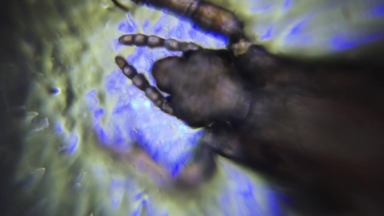Imagem de microscopia da cabeça de um piolho