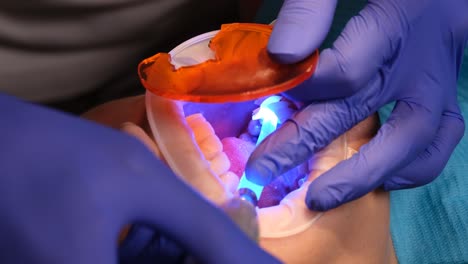 dental procedure with uv light and mouth retractor