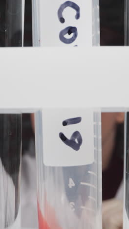 ill patient blood sample in graduated tube with tag covid on rack against concentrated female doctor slow motion. probe lens footage of coronavirus test macro view