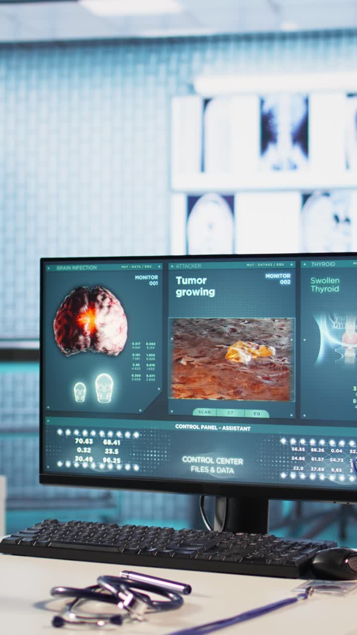 Medical Diagnosis Screen Showing Brain Tumor and Thyroid Swelling