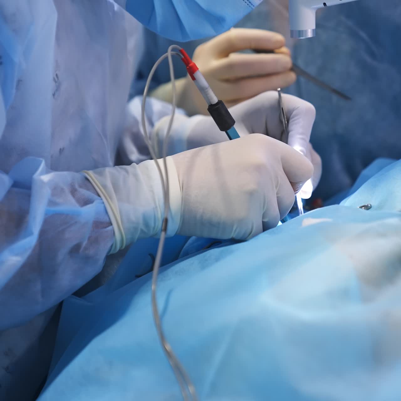 Male surgeon in mask and device glasses operating the patient with tools in both hands. Portrait of a busy doctor performing operation. Side view. Close up