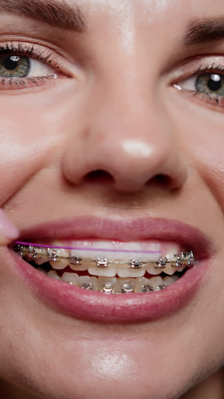 Woman with braces