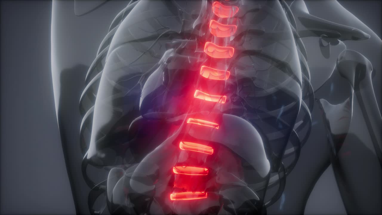 허리  ⁇ 에 허리 통증