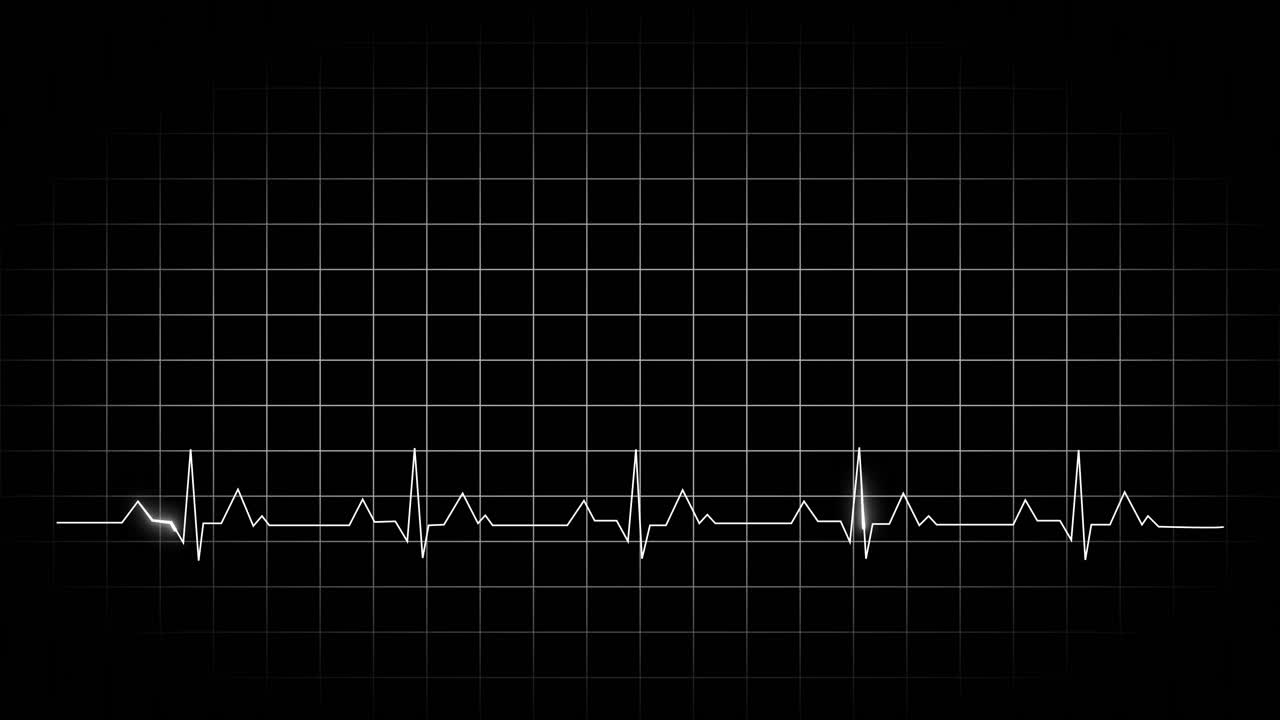 Emergency ekg monitoring. White line electrocardiogram heartbeat on a black background. Looped animation.