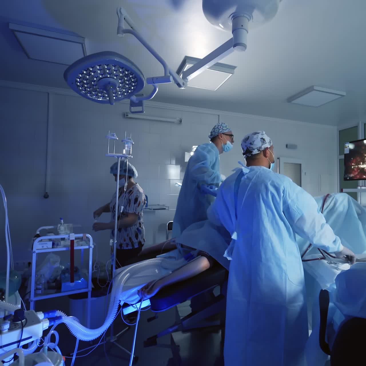 Professional surgery in modern operating room. Team of doctors perform an operation to a patient and and look on the process on the monitor.