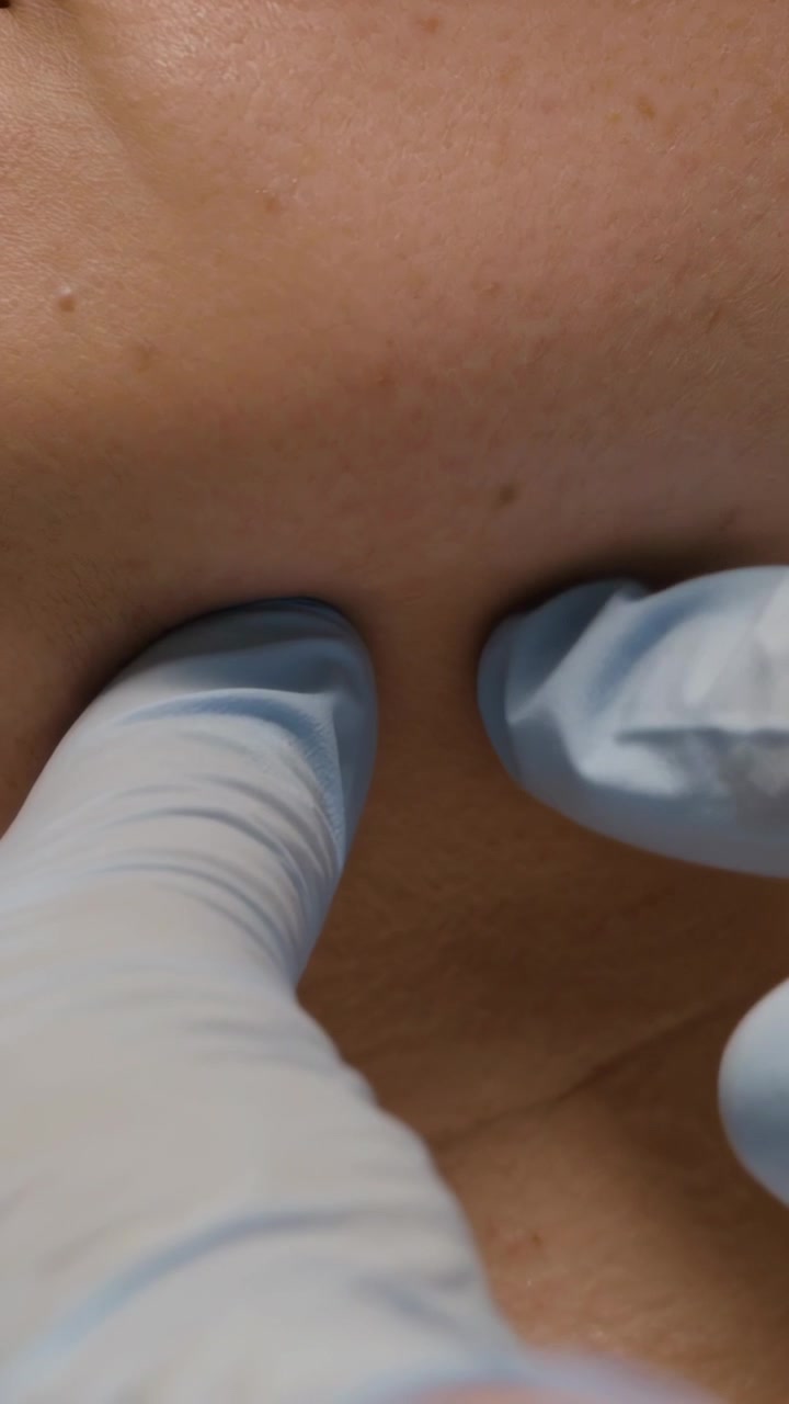 Video verticale: Dita guantate di azzurro che si avvicinano palpando sotto il mento per valutare la pelle in clinica