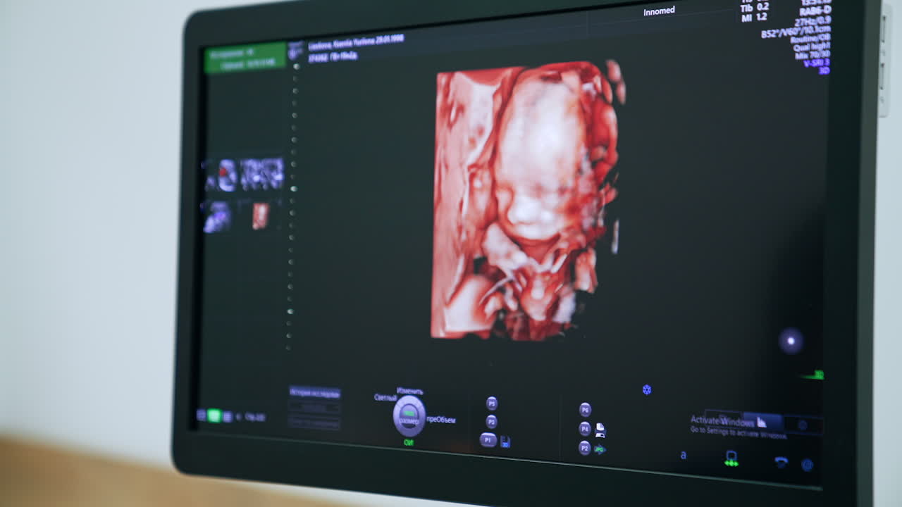 Cute baby image on the monitor of the ultrasound machine. Intrauterine development of a child.
