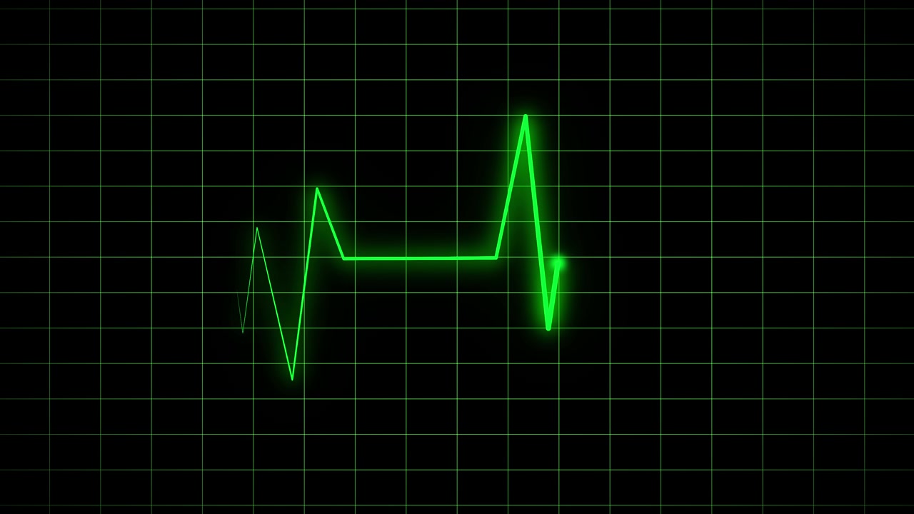 Linea verde del monitoraggio del battito cardiaco EKG su sfondo a griglia