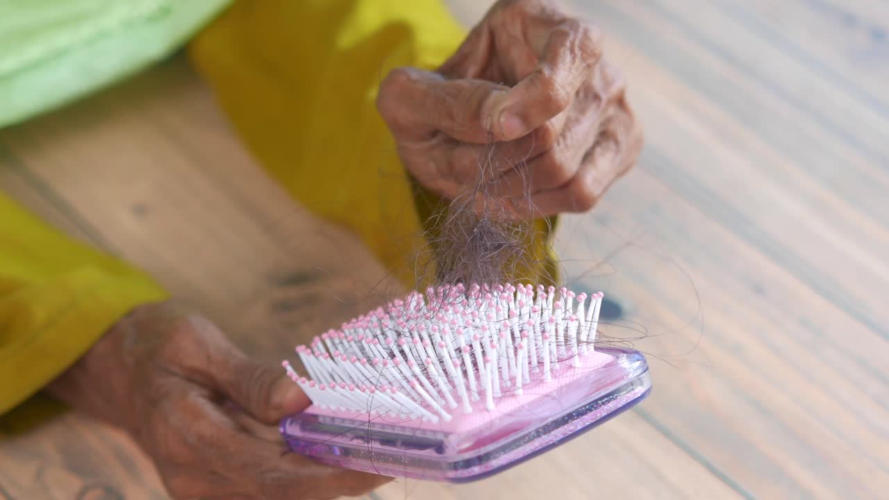 Elderly Person with Hair Loss