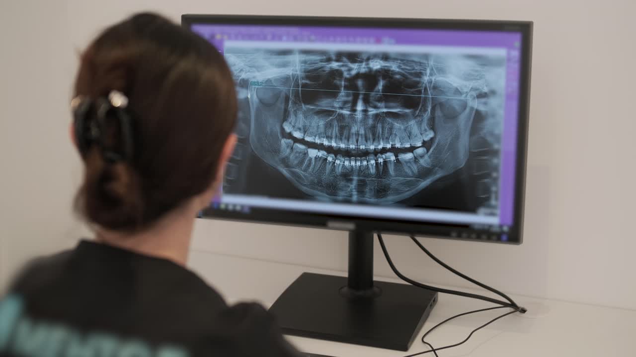 el médico dentista examina una radiografía panorámica de la mandíbula en una pantalla de computadora. el médico muestra un modelo 3d de la boca del paciente, una resonancia magnética. equipo de diagnóstico de dientes en una clínica dental moderna.
