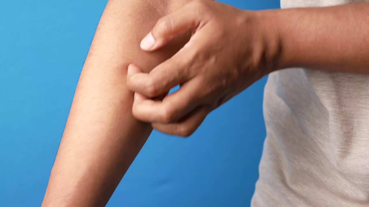 persona rascándose el brazo con picazón