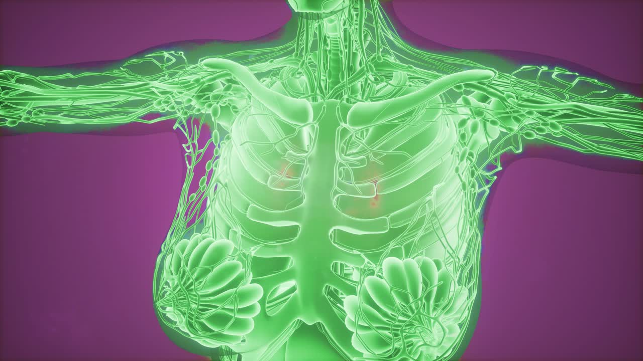 radiografía de mamografía para el diagnóstico del cáncer de mama