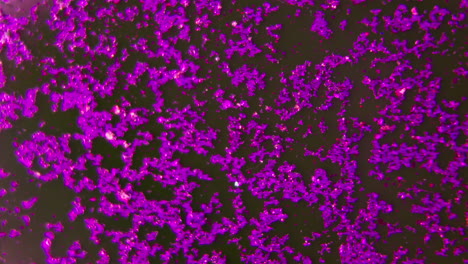 microscopic image of gram-positive bacteria