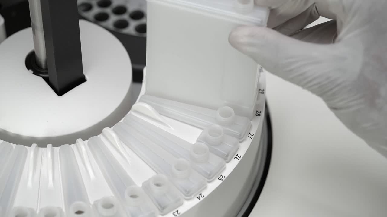 técnico de laboratorio con guante blanco desechable puso la botella de reactivo en el analizador de química de banco