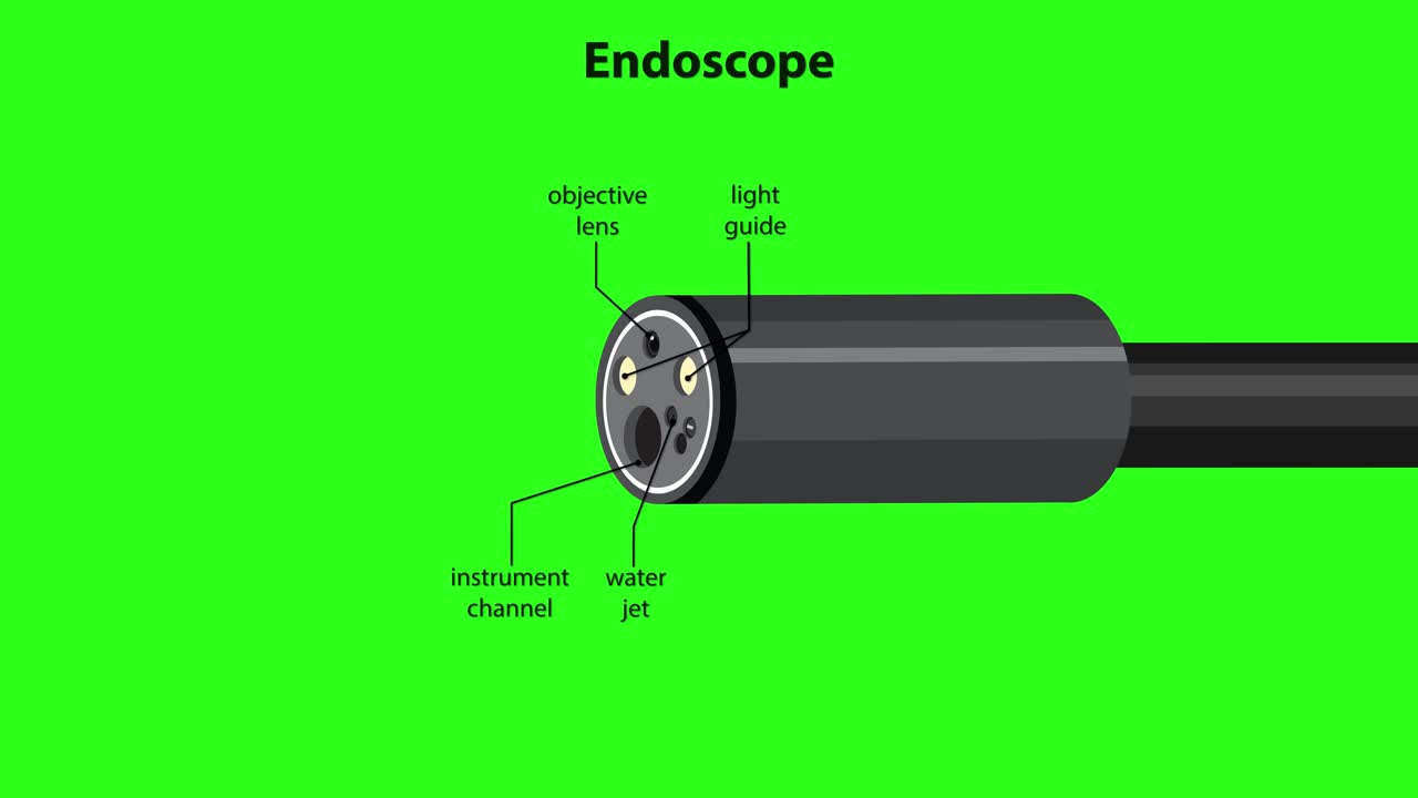 Endoscope tip rotates, labels appear for parts, snare instrument extends, green background, clear diagram