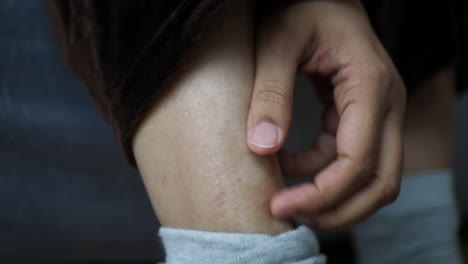 close-up of a person's leg with visible wrinkles and stretch marks.