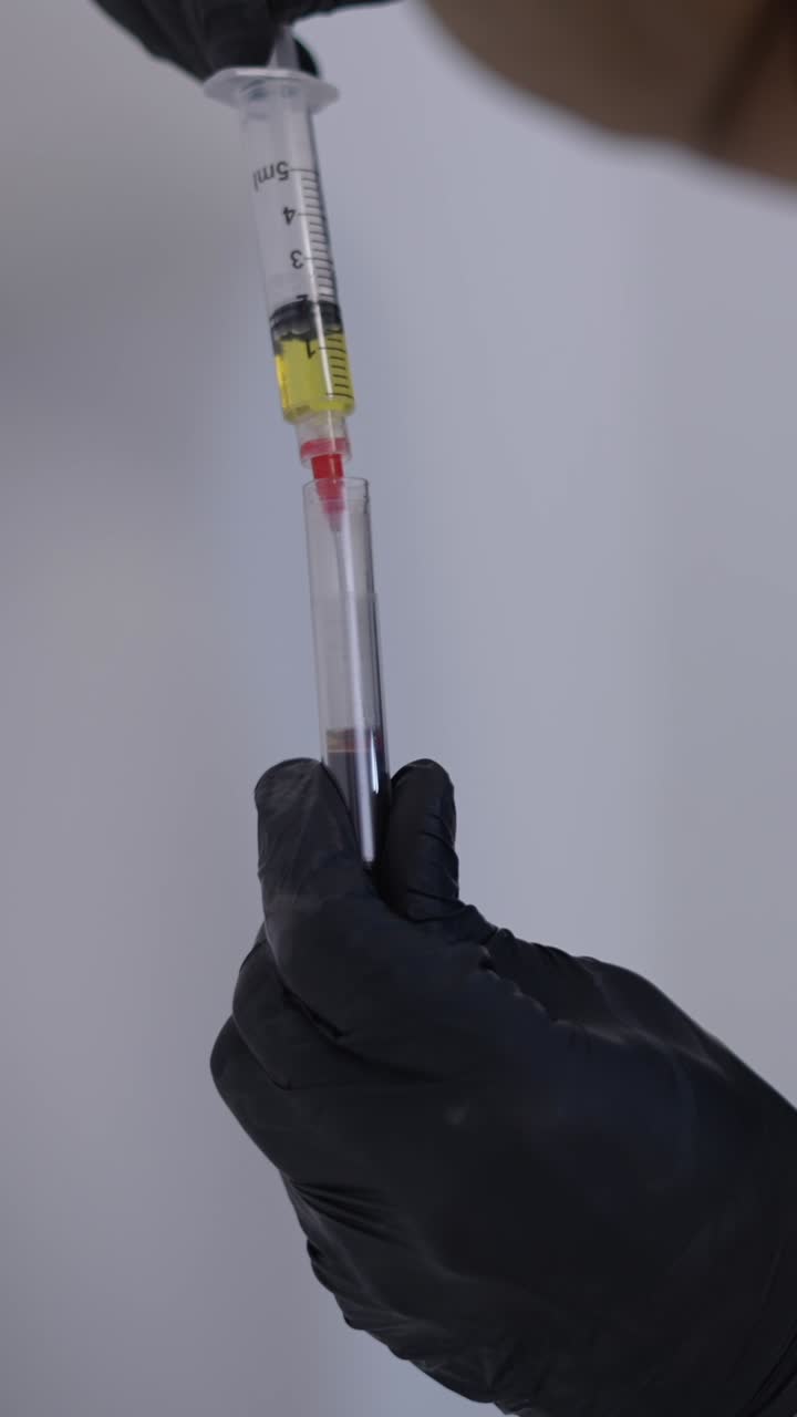 Platelet-Rich Plasma (PRP) Injection