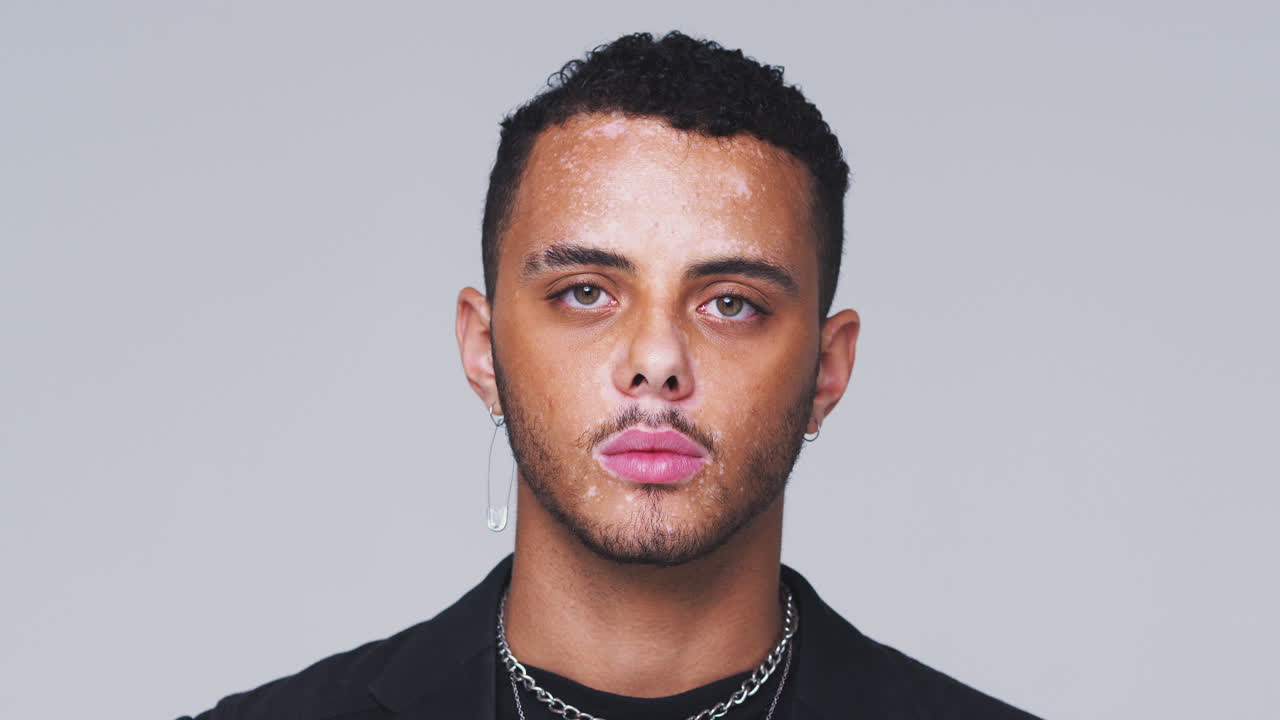 toma de estudio de un hombre sonriente con trastorno de pigmentación de la piel tirando de caras a la cámara en cámara lenta