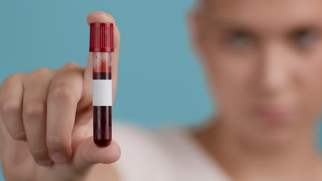 muestra de sangre en tubo de ensayo