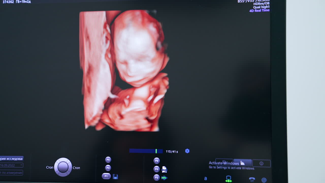 Prenatal image of a baby in mother's womb. Examination of an yet unborn child on the ultrasound equipment. Close up.