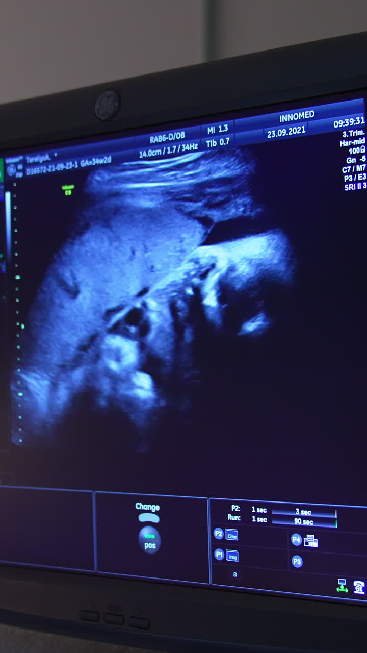 Little baby seen on the screen in mother's womb. Blue monitor showing the child development parameters. Vertical video