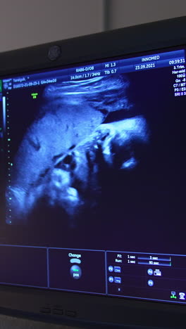little baby seen on the screen in mother's womb. blue monitor showing the child development parameters. vertical video
