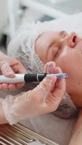 Cosmetóloga-Realizando-Un-Procedimiento-De-Exfoliación,-Regeneración-De-La-Piel-De-La-Mujer,-Microagujas-Dermapen,-Dermastamp