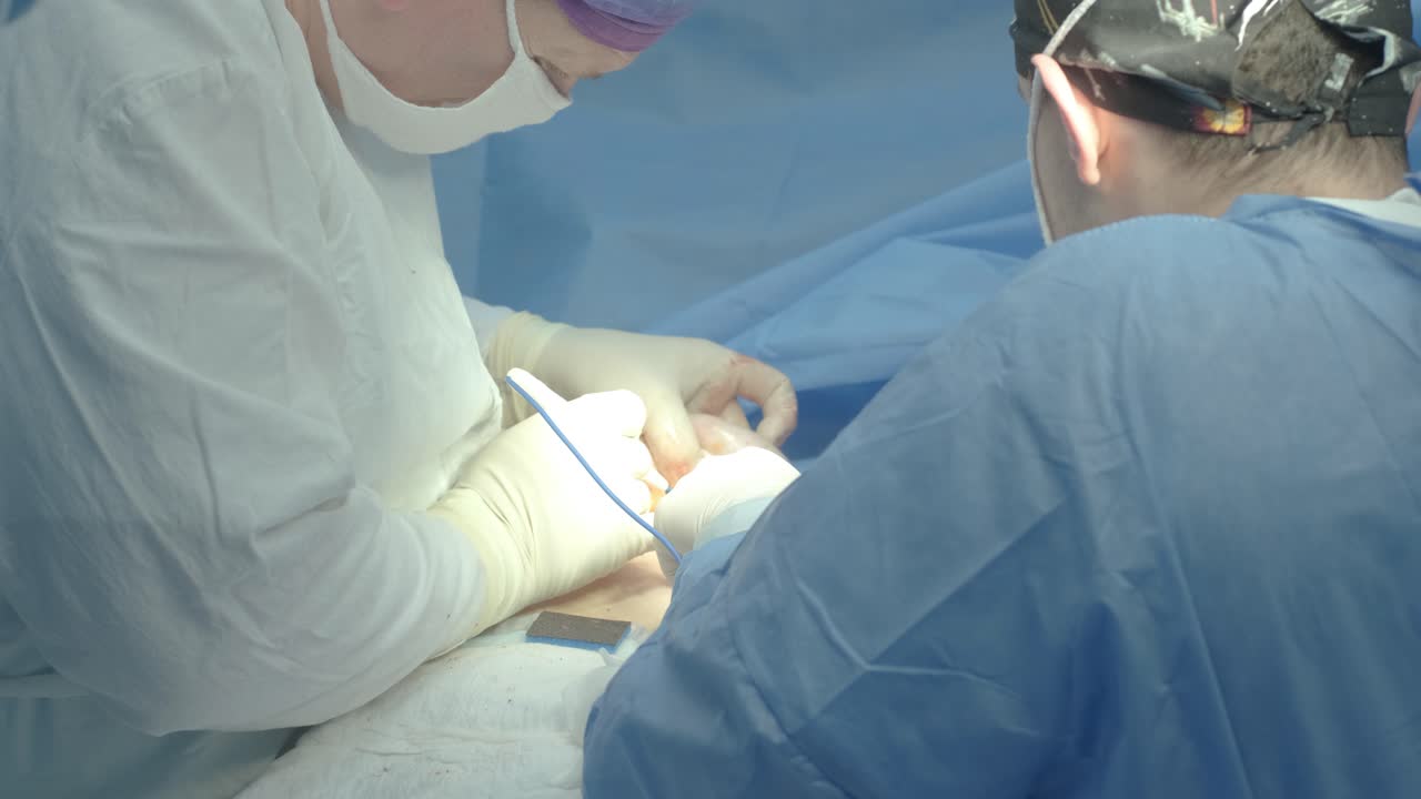 Breast removal surgery under the guidance surgeons team, preparation for breast implant placement