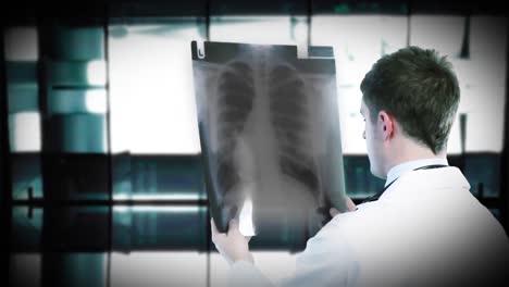 Doctor-holding-an-xray