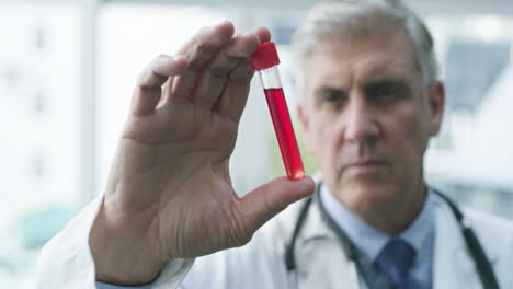 doctor examining blood sample in test tube