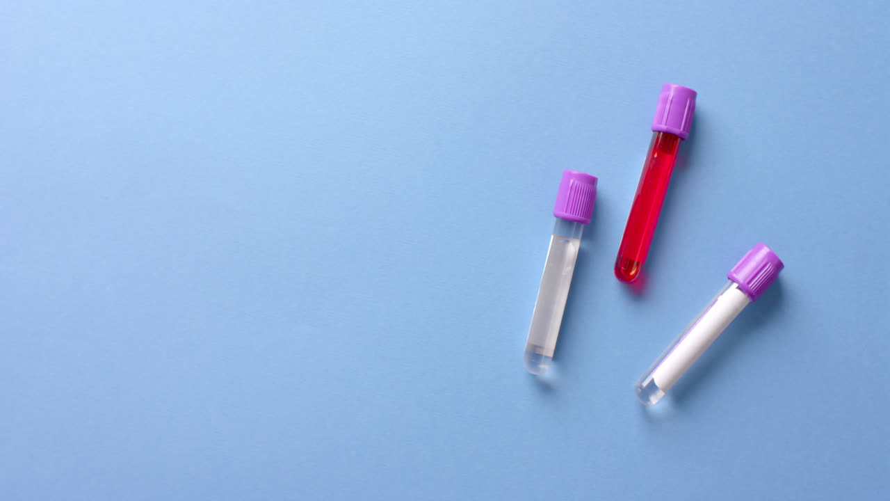 primo piano di campioni di sangue su sfondo blu con spazio di copia, slow motion