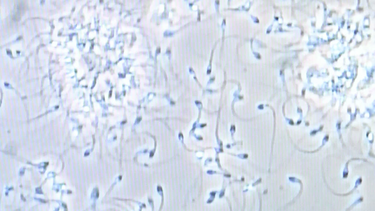 movimiento de espermatozoides bajo el microscopio