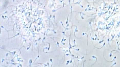 Mover-Espermatozoides-Bajo-El-Microscopio