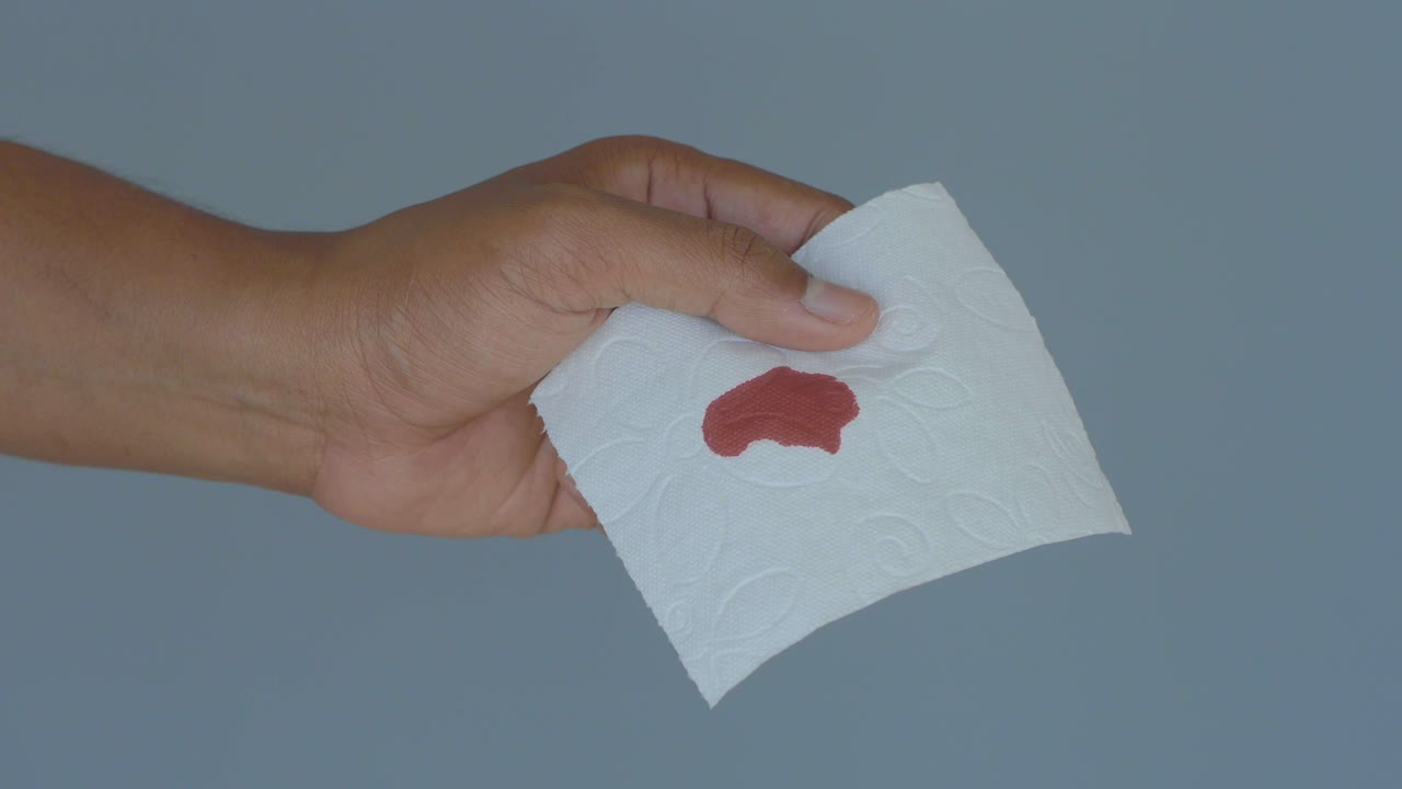 Hand holding a tissue with a blood stain