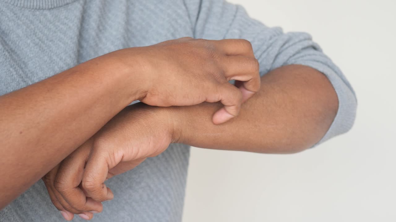 A man scratching his arm