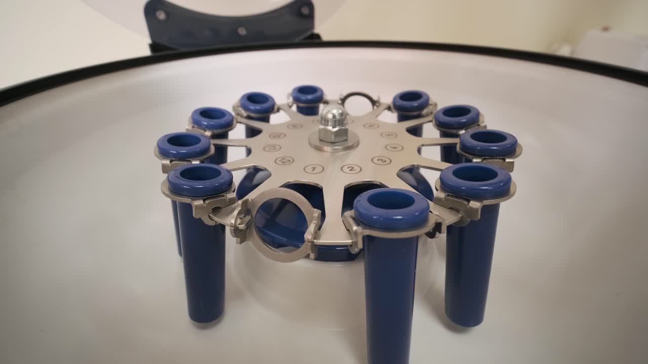 preparación de plasma rico en plaquetas. tubo con sangre en las manos. centrifugadora.