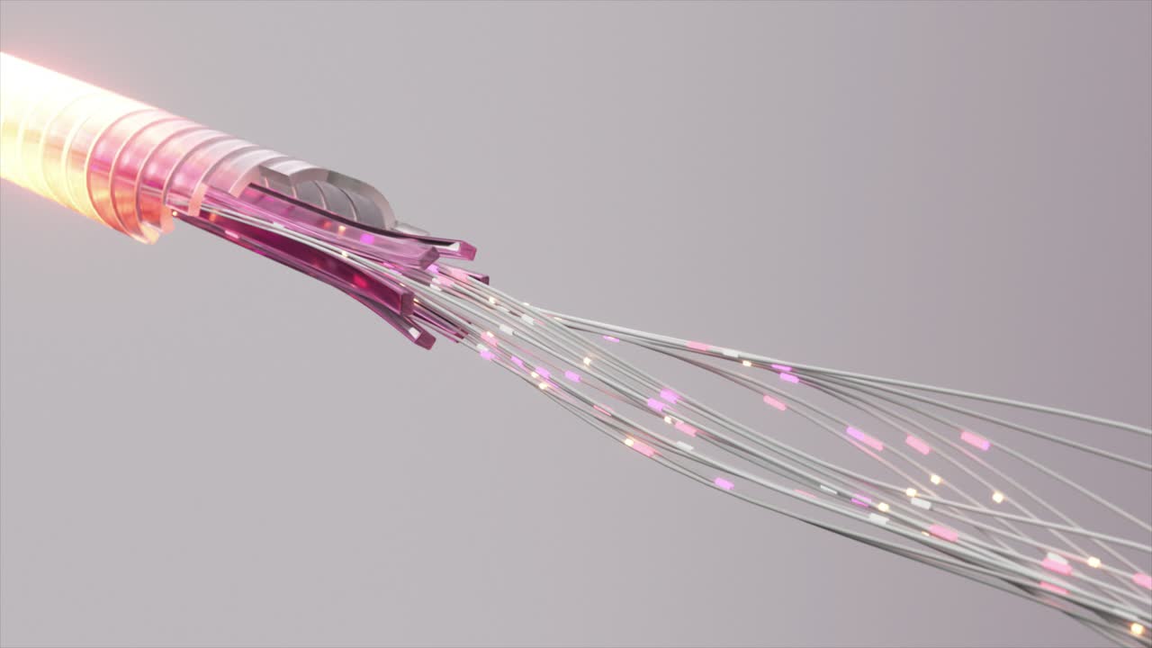 광섬유 케이블 기술