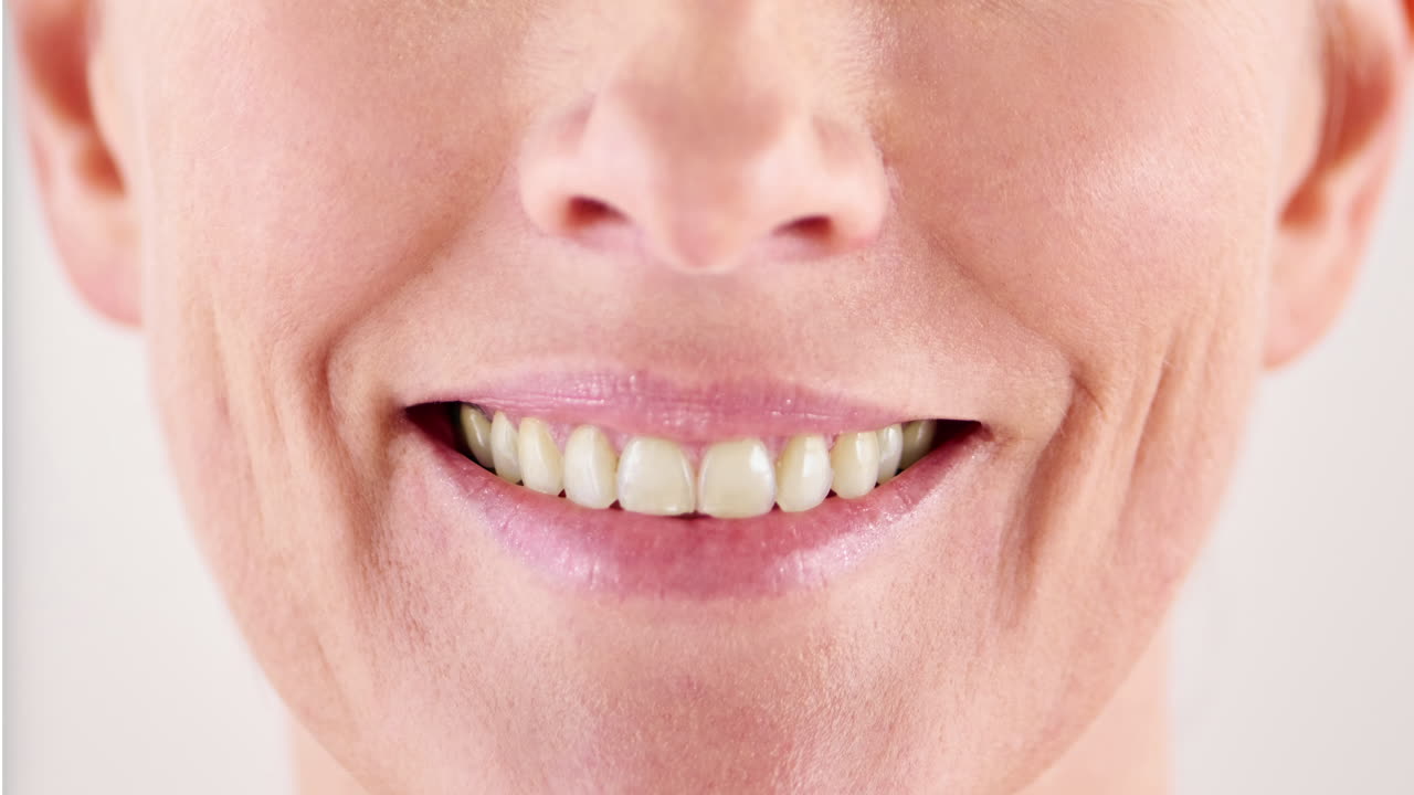 Teeth Whitening Transformation