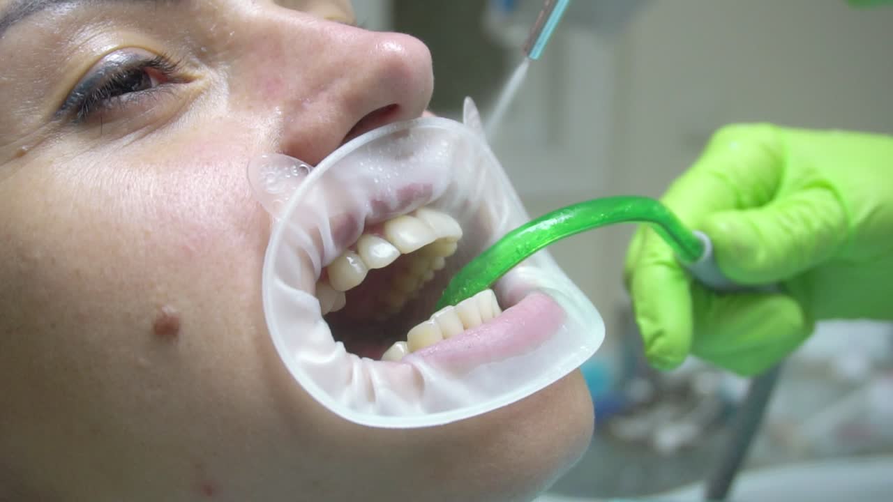 Young woman with and expander in mouth at the dental clinic. Cleaning teeth with water. Modern dental office. Dentist using