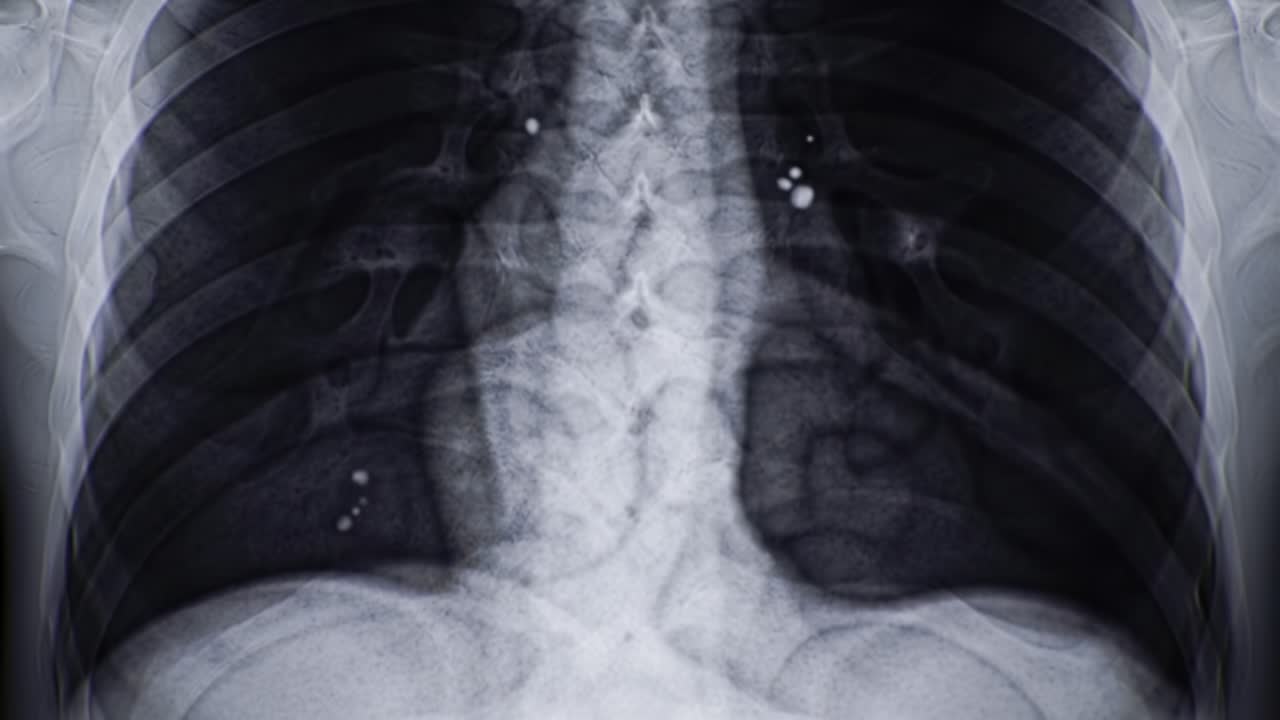 X-ray demonstrates the internal structure of the chest, highlighting the lungs and heart for assessment of respiratory health. Useful for diagnosing various conditions affecting the chest area.