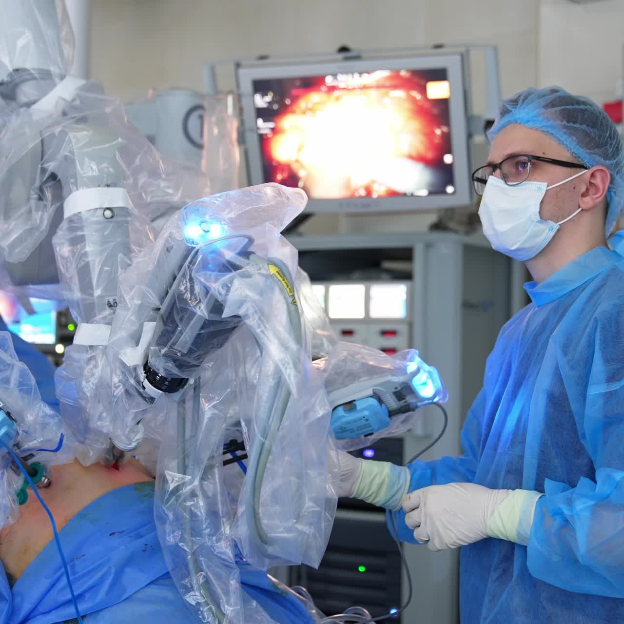 Four robotic arms are input into patient's belly. Surgeon holds the device and watches the process on the monitor