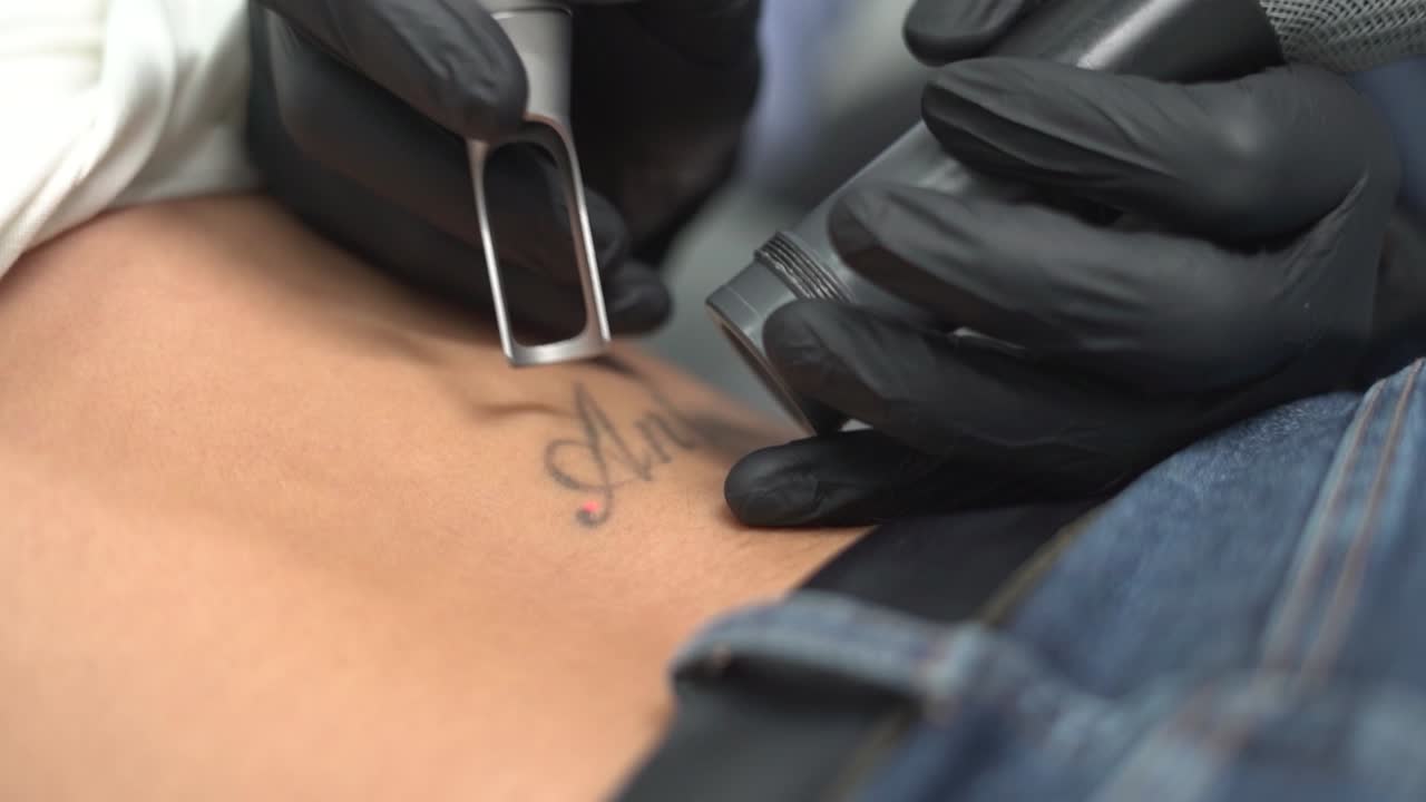 удалить татуировку женщины, удалить или стереть