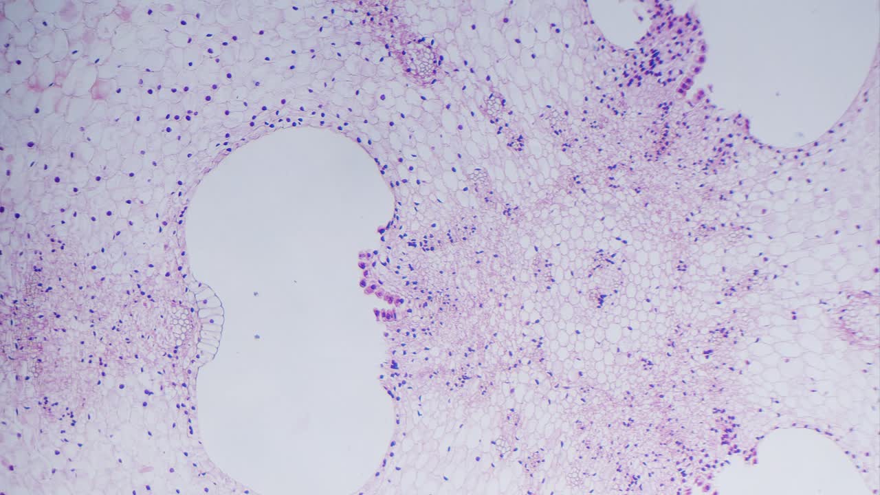 Ovary of lilium transverse section, stained, under microscope bright field view