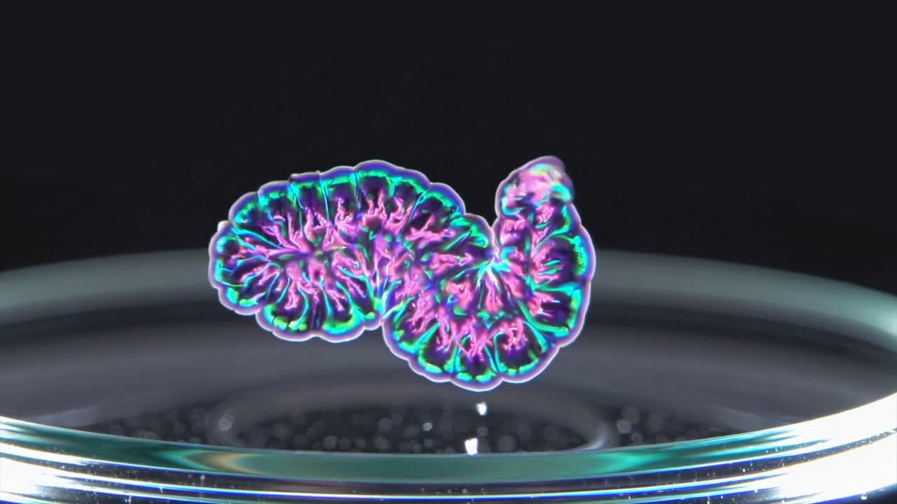 CGI animation of Hodgkin lymphoma tumor growth, visualizing cancer cell movement and the progression of the disease within the lymphatic system.