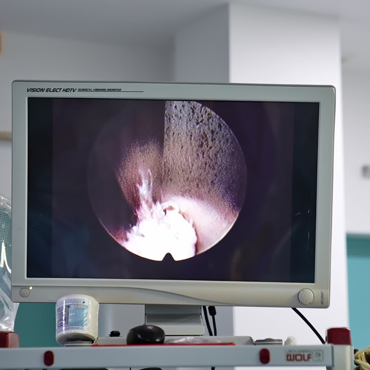 Monitor funzionante in sala operatoria con operazione in corso. Attrezzatura robotica che esegue un intervento di neurochirurgia mininvasiva