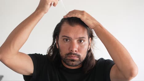 Mann,-Der-Minoxidil-Mit-Einer-Pipette-Ins-Haar-Einträgt,-Kahlheit,-Zurückweichender-Haaransatz