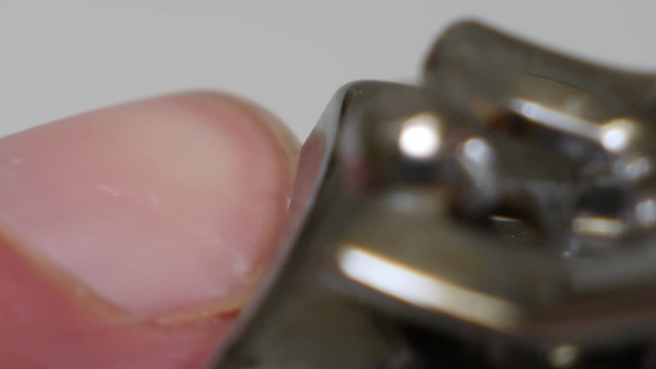 macro primer plano de la persona cortada piel áspera alrededor de la uña