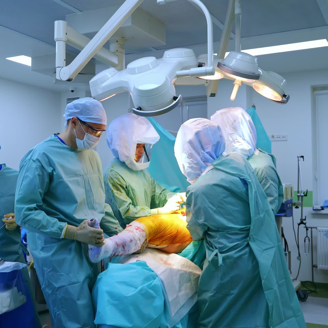 Surgical team performing trauma operation on a leg. Leaving the surgery room and looking at procedure through the window in a door