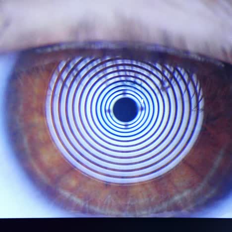 patient's eye on screen. computer screen showing eyeball problems. optometrist checks vision using autorefractor. close-up